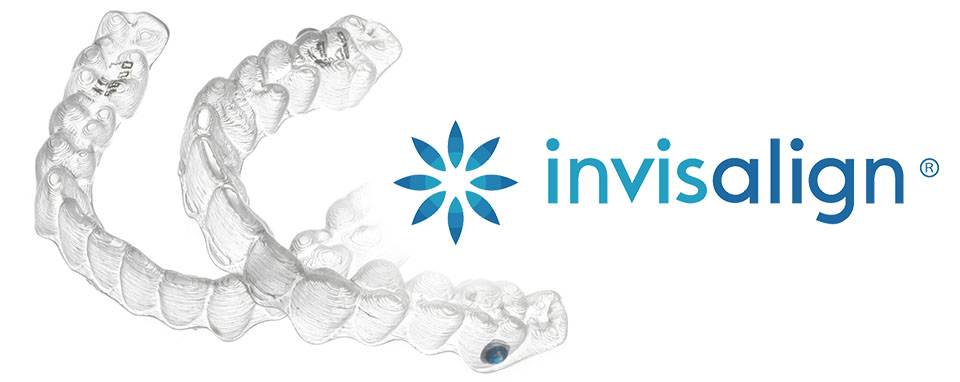 Invisalign Braces