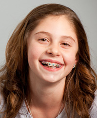 kids braces alpharetta