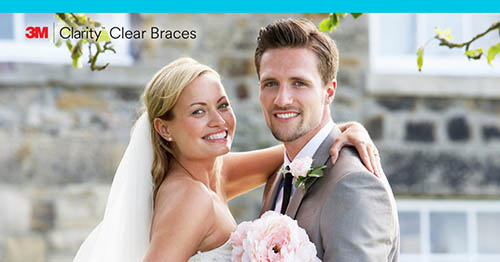 Clear aligners wedding Atlanta