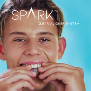 spark clear aligner fitting