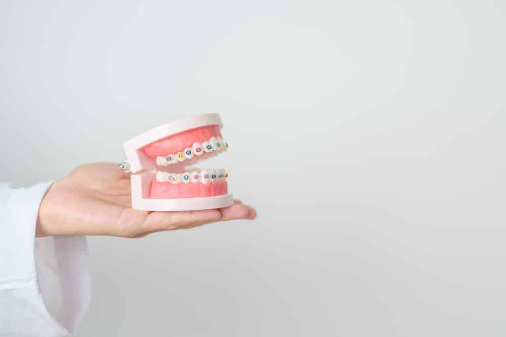 model Braces in Johns Creek, GA