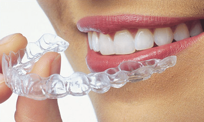 Read more about the article Clear Aligners in Johns Creek: Who Is NOT a Good Candidate?
