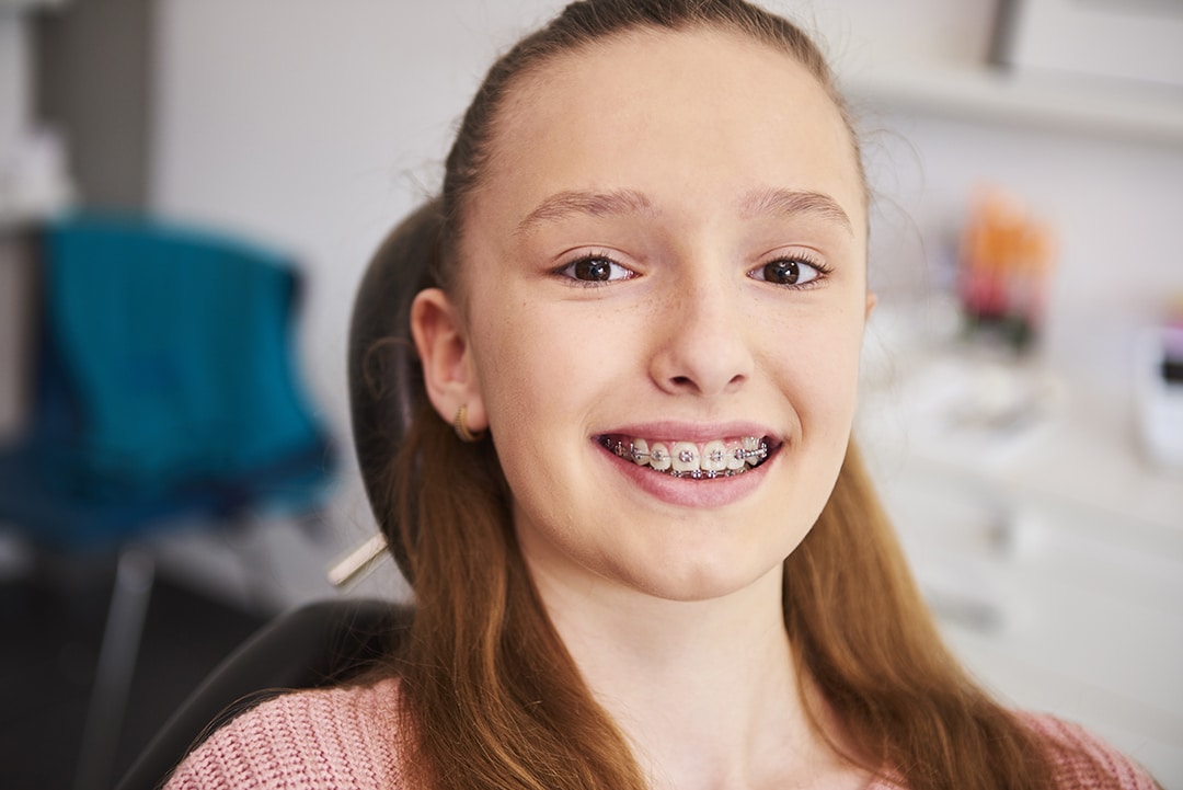 Read more about the article Braces for Teens in Johns Creek: How to Make Treatment Easier at School and in Sports