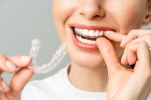 Close-up of a person placing a clear aligner onto their teeth while holding another aligner tray in hand