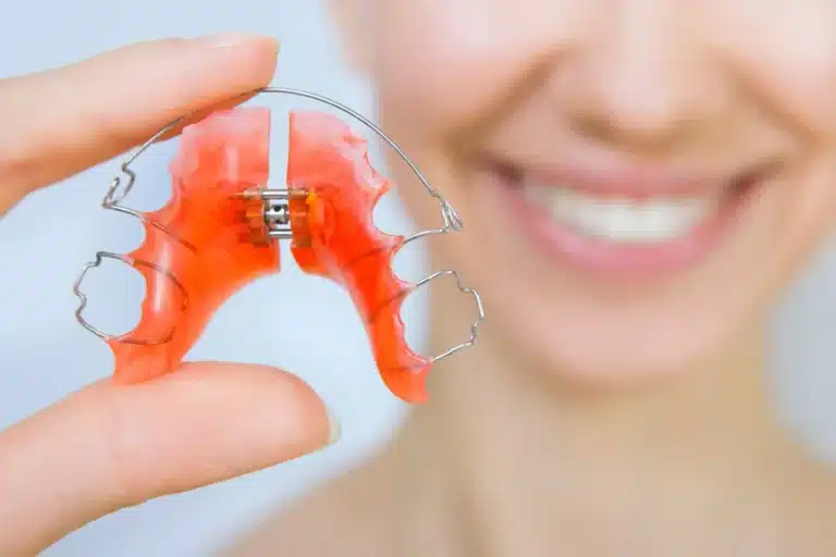 Close-up of a removable dental retainer appliance held between fingers with a blurred smiling person in the background