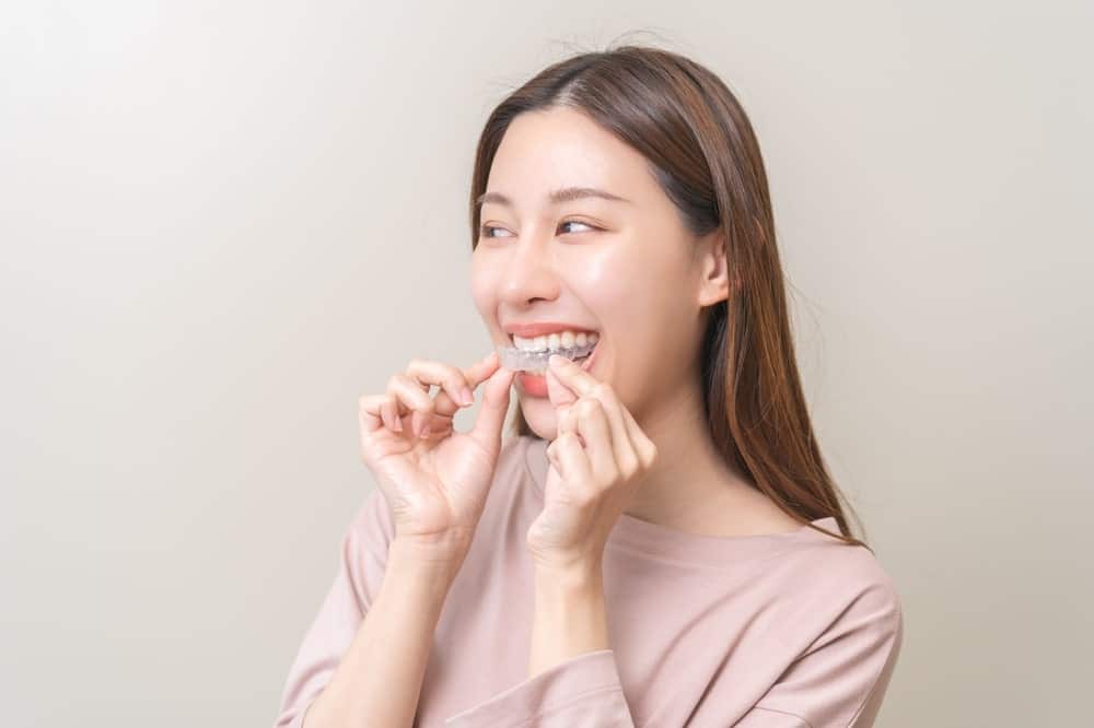 Patient inserting clear aligners to straighten teeth during orthodontic treatment with a removable aligner system.