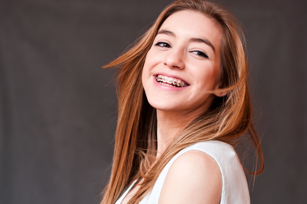 Read more about the article Why Metal Braces Are Still One of the Most Reliable Orthodontic Treatments